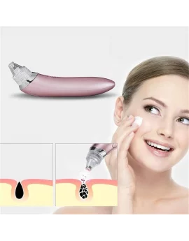 Black head vacuum acne cleaner pore remover skin facial cleanser care xinshiji xn-8030-rose gold